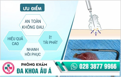 Bệnh sùi mào gà, căn bệnh dễ lây nhiễm nhưng khó điều trị